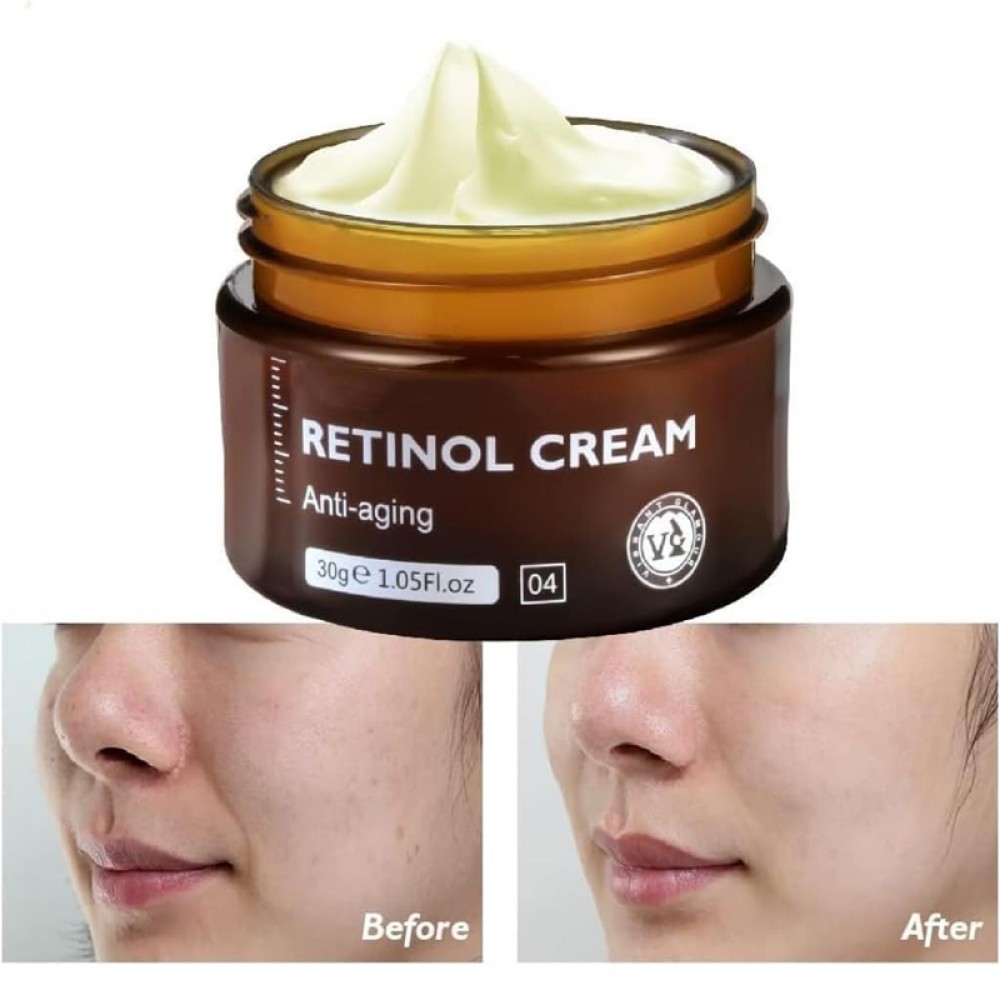 Retinol Face Cream For Skin Whitening, Face Moisturnizer
